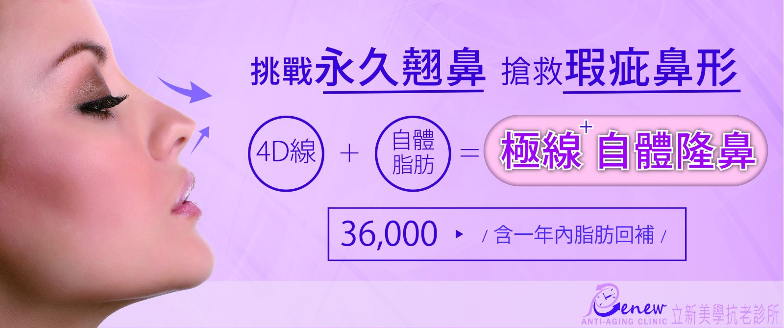 4D線材隆鼻和自體脂肪移植的技術， 打造出全新概念的微整注射隆鼻。 - 20151003141014-853364738.jpg(圖)