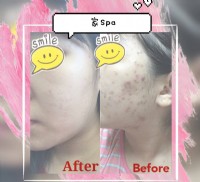 學生價 平價做臉 臉部保養   Spa   寶貝肌療程_圖片(1)