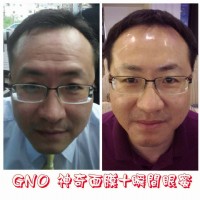 GNO 超級醫美新科技_圖片(3)